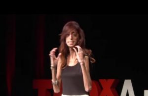How do you define yourself? | Lizzie Velasquez | TEDxAustinWomen